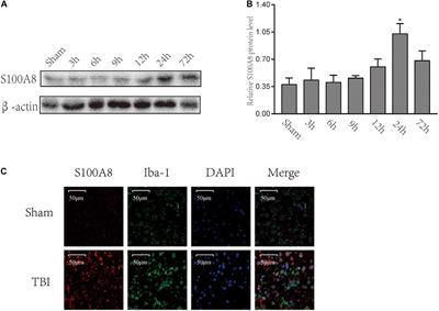 S100A8 Promotes Inflammation via Toll-Like Receptor 4 After Experimental Traumatic Brain Injury